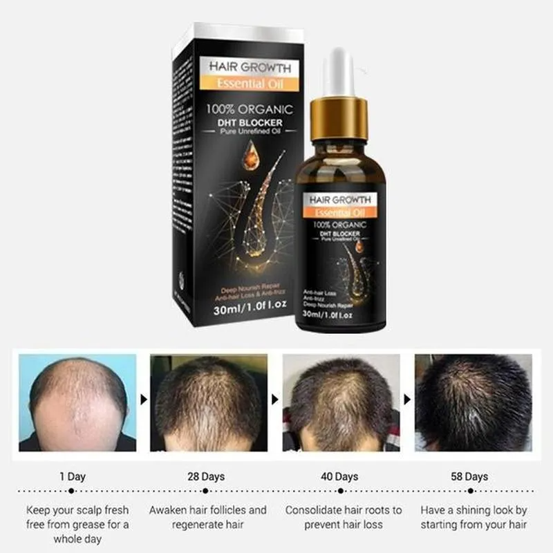 Restore Hair Growth Serum