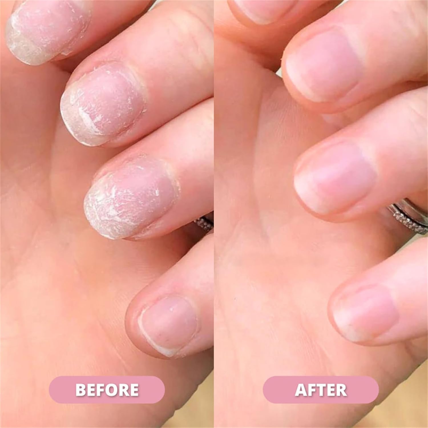 NAIL GROWTH OIL