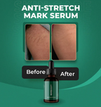 Markaway Stretch Mark Serum