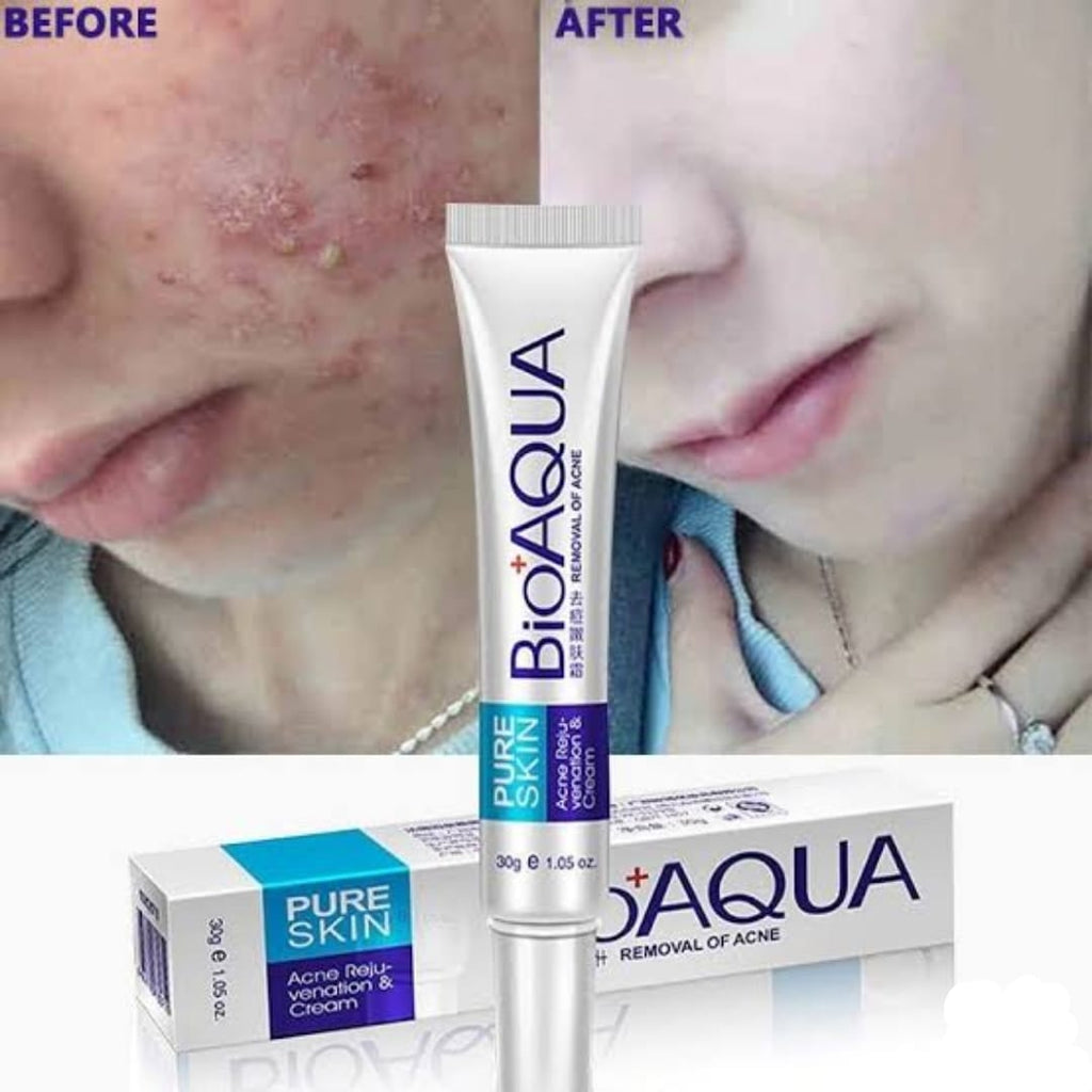BIOAQUA Anti Acne Cream Acne Scar Removal Cream