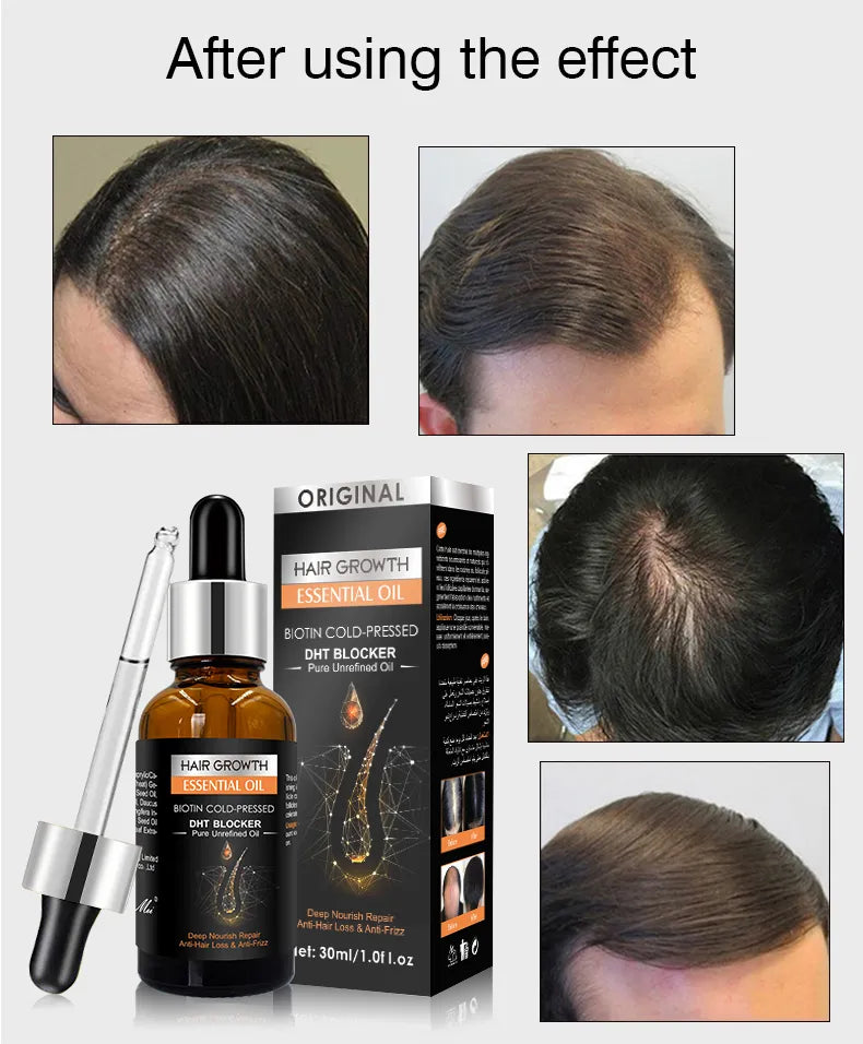 Restore Hair Growth Serum