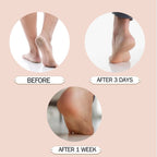Heel Moisturizing Socks, Softens and Prevents Cracked Heels, Exfoliating Heel Protectors