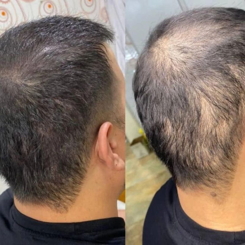 FEG Plus Hair Growth Spray – 50ml
