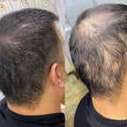 FEG Plus Hair Growth Spray – 50ml