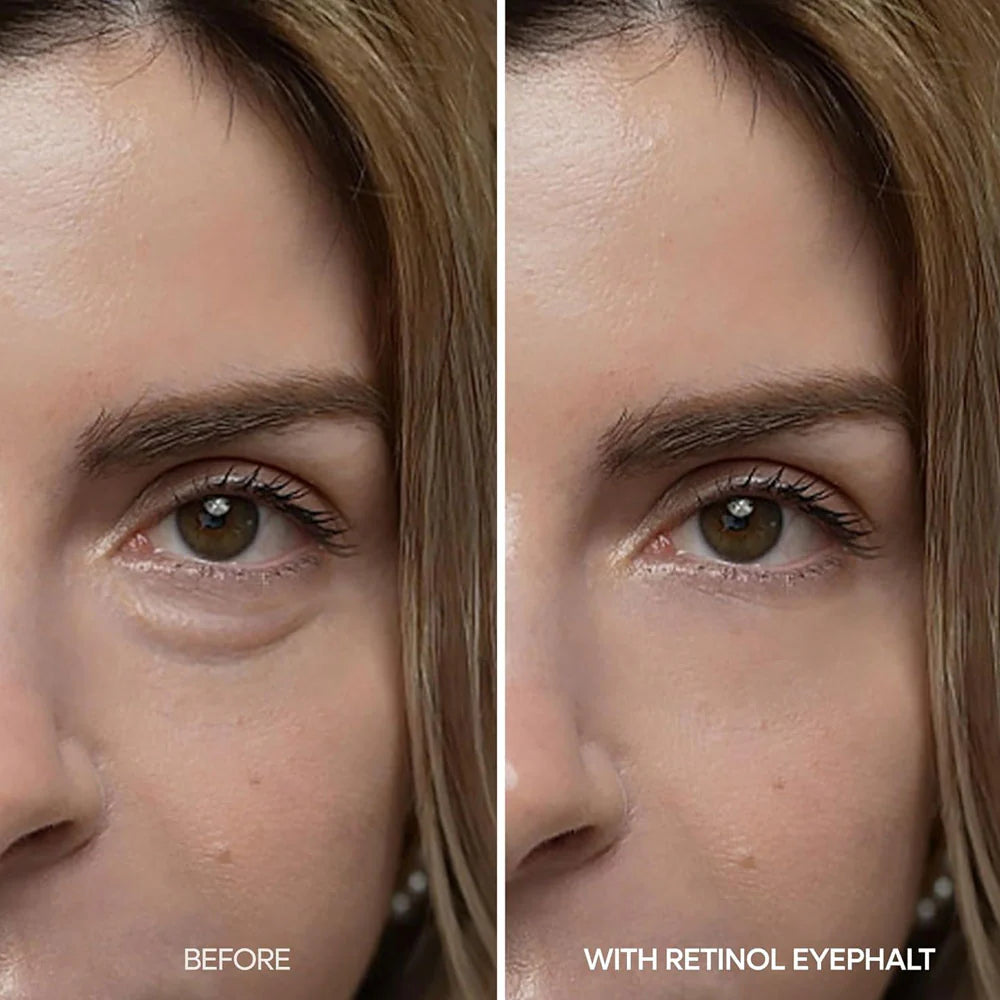 Dr.Melaxin Eyephalt Retinol Eyebag Cream 10g