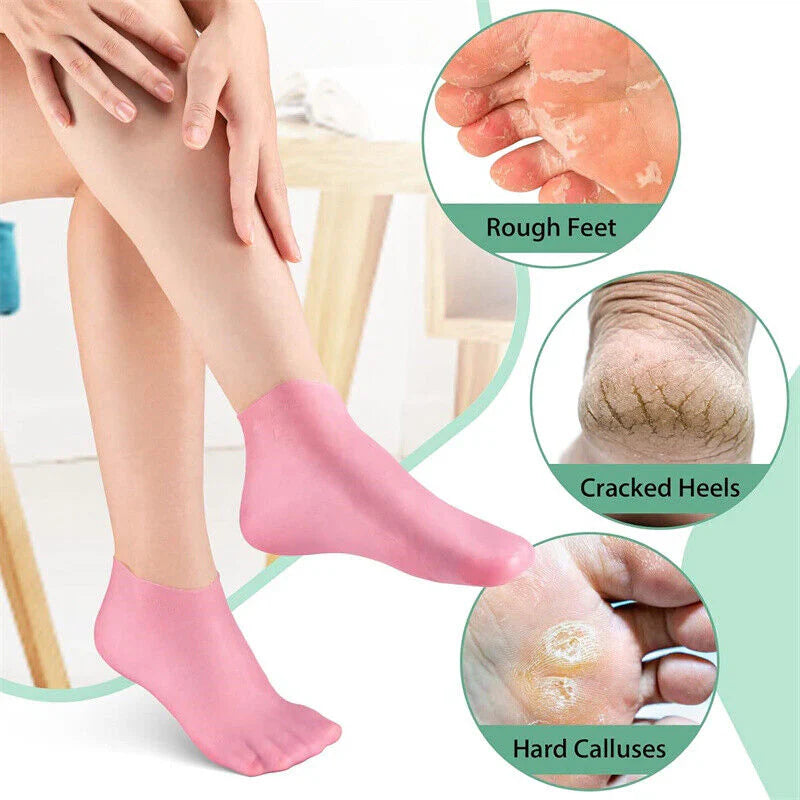 Silicone Moisturizing Hand Gloves for Dry Cracked Skin