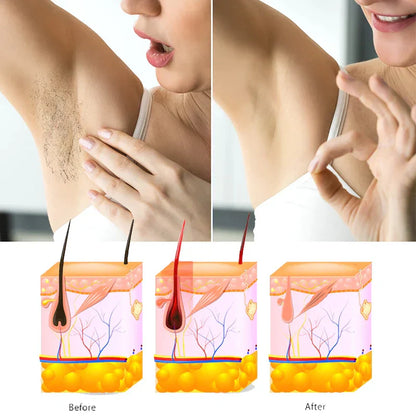 Heaven Dove Hair Removal Spray (Unisex