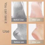 Heel Moisturizing Socks, Softens and Prevents Cracked Heels, Exfoliating Heel Protectors