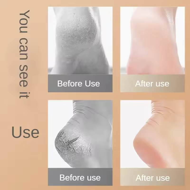 Heel Moisturizing Socks, Softens and Prevents Cracked Heels, Exfoliating Heel Protectors