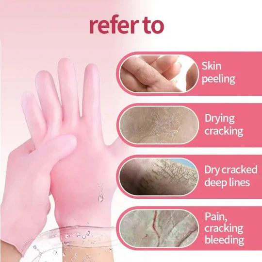 Silicone Moisturizing Hand Gloves for Dry Cracked Skin