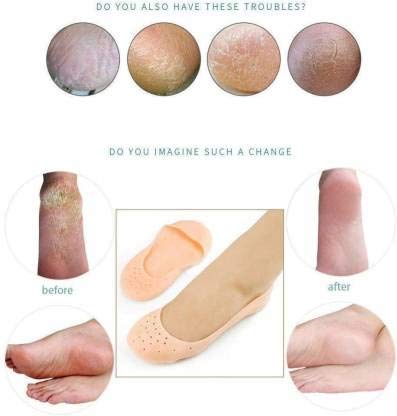 Silicone Mostirising Heel Socks for Dry Cracked Heels