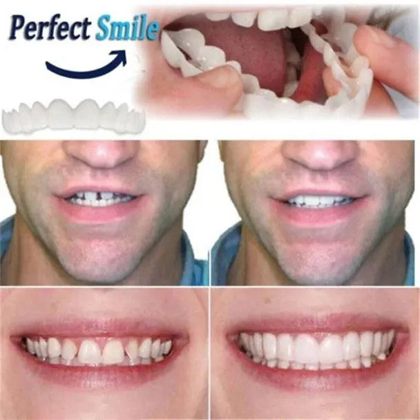 snapon peerfect smile 