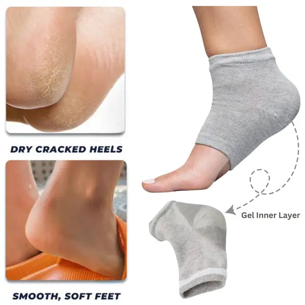 Heel Moisturizing Socks, Softens and Prevents Cracked Heels, Exfoliating Heel Protectors