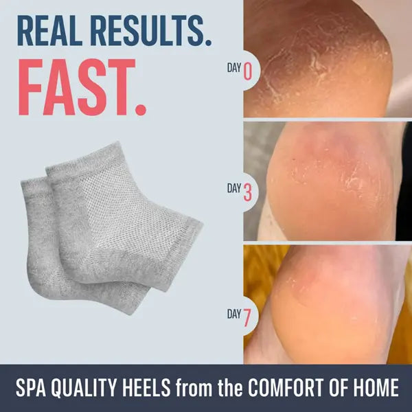 Heel Moisturizing Socks, Softens and Prevents Cracked Heels, Exfoliating Heel Protectors